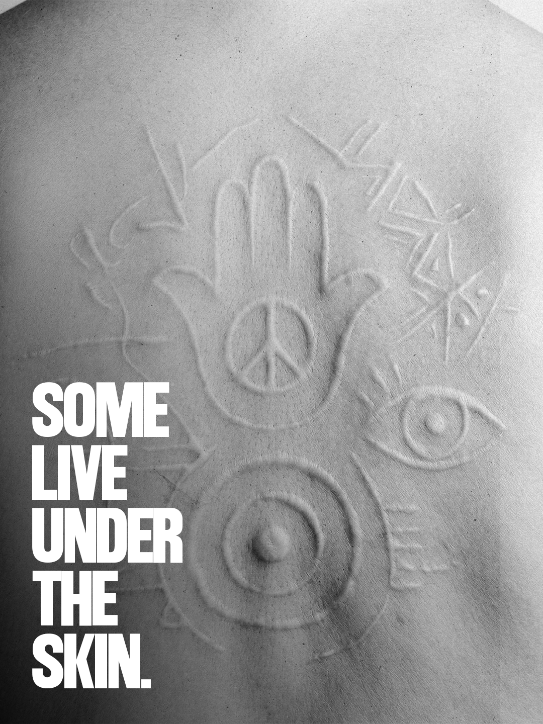 Some live under the skin